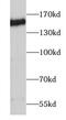 Desmoglein 2 antibody, FNab02544, FineTest, Western Blot image 