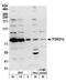 Forkhead Box O1 antibody, A300-297A, Bethyl Labs, Western Blot image 