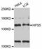 HPS5 Biogenesis Of Lysosomal Organelles Complex 2 Subunit 2 antibody, abx125962, Abbexa, Western Blot image 