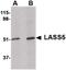 Ceramide Synthase 5 antibody, PA5-20647, Invitrogen Antibodies, Western Blot image 