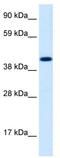Insulinoma-associated protein 1 antibody, TA329735, Origene, Western Blot image 