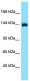 Diacylglycerol Kinase Delta antibody, TA337750, Origene, Western Blot image 