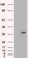 Sterol O-acyltransferase 2 antibody, TA501238, Origene, Western Blot image 