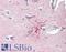 Solute Carrier Family 8 Member A3 antibody, LS-B15815, Lifespan Biosciences, Immunohistochemistry paraffin image 