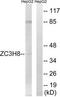 Zinc Finger CCCH-Type Containing 8 antibody, TA312645, Origene, Western Blot image 