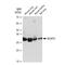 B Cell Receptor Associated Protein 31 antibody, GTX03245, GeneTex, Western Blot image 