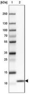 Cytochrome C Oxidase Copper Chaperone COX17 antibody, NBP2-30980, Novus Biologicals, Western Blot image 