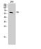 Tyrosine Hydroxylase antibody, STJ96005, St John