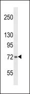 SH2B adapter protein 1 antibody, 58-193, ProSci, Western Blot image 