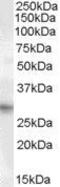 Paired Related Homeobox 1 antibody, GTX88910, GeneTex, Western Blot image 