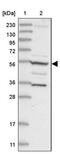 Family With Sequence Similarity 114 Member A2 antibody, PA5-57440, Invitrogen Antibodies, Western Blot image 