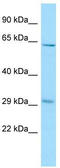 Receptor Accessory Protein 3 antibody, TA334158, Origene, Western Blot image 