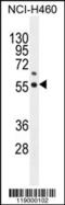 Ubiquinone biosynthesis monooxygenase COQ6 antibody, 55-857, ProSci, Western Blot image 