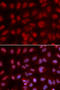 Paired amphipathic helix protein Sin3a antibody, 16-224, ProSci, Immunofluorescence image 