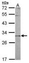 Coiled-Coil-Helix-Coiled-Coil-Helix Domain Containing 3 antibody, PA5-31578, Invitrogen Antibodies, Western Blot image 