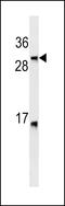 Lymphotoxin Beta antibody, LS-C163915, Lifespan Biosciences, Western Blot image 