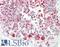 EPH Receptor A10 antibody, LS-B10732, Lifespan Biosciences, Immunohistochemistry frozen image 