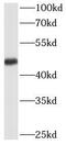 Transcription Factor AP-2 Alpha antibody, FNab08617, FineTest, Western Blot image 