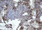 Mitochondrial Intermediate Peptidase antibody, M05926-1, Boster Biological Technology, Immunohistochemistry paraffin image 