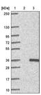 2-aminoethanethiol dioxygenase antibody, NBP1-88530, Novus Biologicals, Western Blot image 