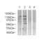 Histone-lysine N-methyltransferase NSD3 antibody, PA5-19427, Invitrogen Antibodies, Western Blot image 