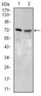 Bile acyl-CoA synthetase antibody, GTX60693, GeneTex, Western Blot image 