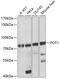 Protection of telomeres protein 1 antibody, 15-787, ProSci, Western Blot image 