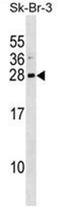 ADP Ribosylation Factor Like GTPase 1 antibody, AP50241PU-N, Origene, Western Blot image 