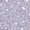 Immunoglobin Superfamily Member 21 antibody, NBP1-81191, Novus Biologicals, Immunohistochemistry paraffin image 