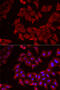 UMP/CMPK antibody, 22-313, ProSci, Immunofluorescence image 
