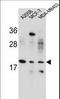 Variable Charge X-Linked antibody, LS-C160507, Lifespan Biosciences, Western Blot image 