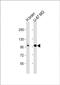 Anoctamin-5 antibody, PA5-72534, Invitrogen Antibodies, Western Blot image 