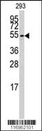 Cytochrome P450 Family 26 Subfamily B Member 1 antibody, MBS9214470, MyBioSource, Western Blot image 