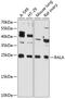 RAS Like Proto-Oncogene A antibody, 14-123, ProSci, Western Blot image 