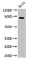 Acylaminoacyl-Peptide Hydrolase antibody, LS-C394610, Lifespan Biosciences, Western Blot image 