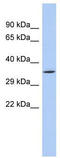 NAD-dependent ADP-ribosyltransferase sirtuin-4 antibody, TA330549, Origene, Western Blot image 