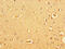 Heat-stable enterotoxin receptor antibody, OACA09780, Aviva Systems Biology, Immunohistochemistry frozen image 
