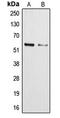 Cytochrome P450 Family 3 Subfamily A Member 4 antibody, LS-C352090, Lifespan Biosciences, Western Blot image 