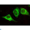 Keratin 7 antibody, LS-C812934, Lifespan Biosciences, Immunofluorescence image 