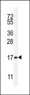 Sperm Acrosome Associated 5B antibody, PA5-48280, Invitrogen Antibodies, Western Blot image 