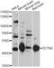 Dynactin subunit 2 antibody, A14841, ABclonal Technology, Western Blot image 