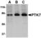 Protein-tyrosine kinase 7 antibody, MBS150618, MyBioSource, Western Blot image 