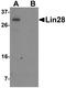 Lin-28 Homolog A antibody, TA326716, Origene, Western Blot image 