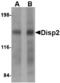 Dispatched RND Transporter Family Member 2 antibody, MBS150321, MyBioSource, Western Blot image 