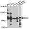 Mediator of RNA polymerase II transcription subunit 24 antibody, A8059, ABclonal Technology, Western Blot image 