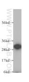 Capping Actin Protein Of Muscle Z-Line Subunit Alpha 1 antibody, 11806-1-AP, Proteintech Group, Western Blot image 