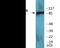 Hepatocyte Growth Factor-Regulated Tyrosine Kinase Substrate antibody, EKC2293, Boster Biological Technology, Western Blot image 