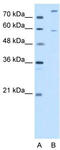Peroxisomal carnitine O-octanoyltransferase antibody, TA346810, Origene, Western Blot image 