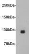 Junctophilin 2 antibody, NBP2-66914, Novus Biologicals, Western Blot image 