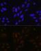 ETS Variant 4 antibody, GTX54006, GeneTex, Immunofluorescence image 